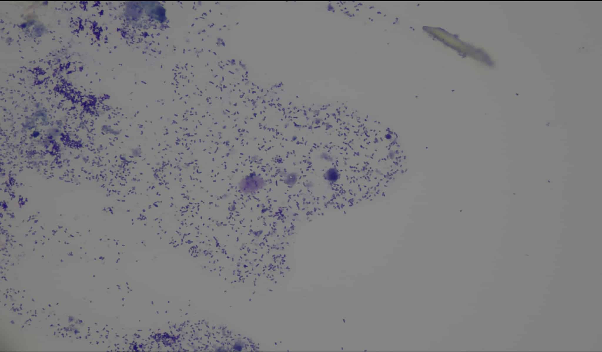 Massenhaft nachgewiesene Pseudomonas-Bakterien in 400-facher Vergrößerung